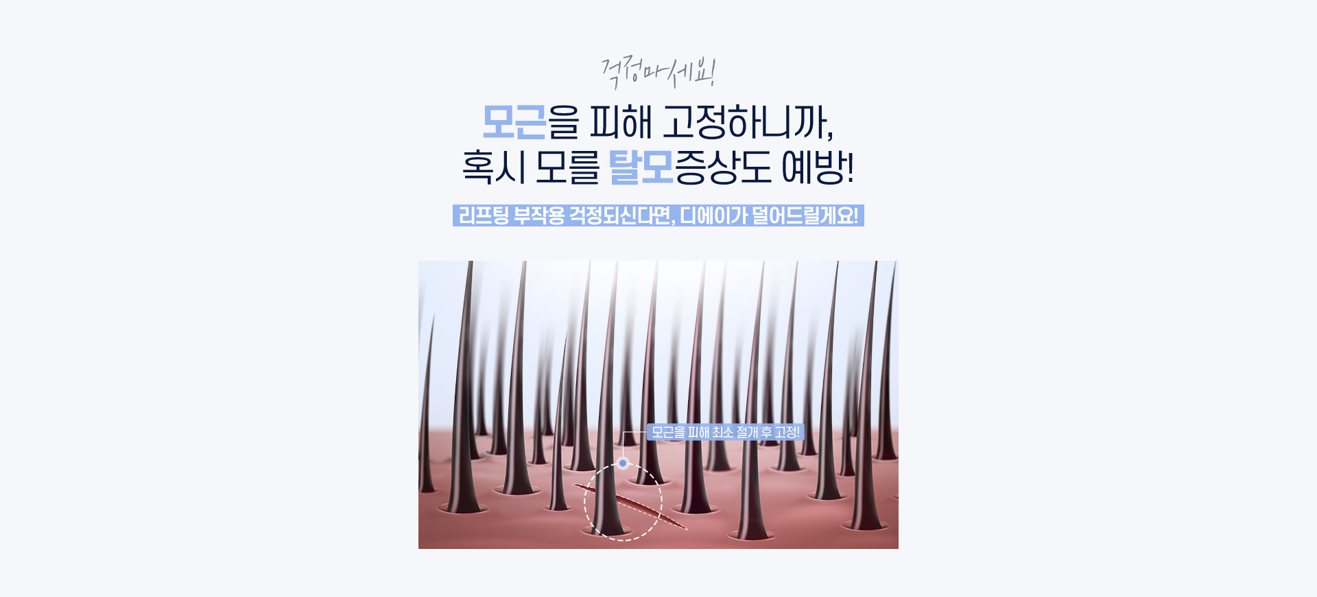 디에이 연조직윤곽술