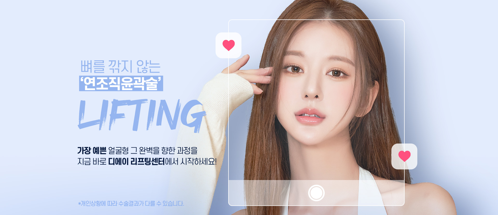 디에이 연조직윤곽술
