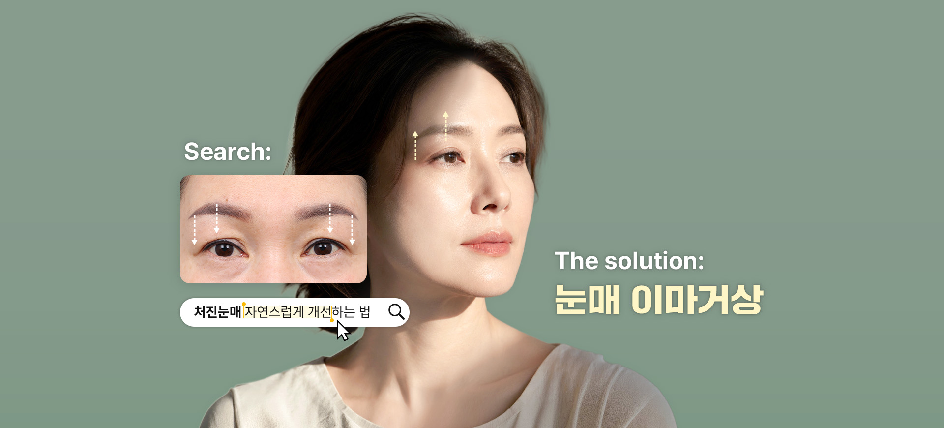Search: 처진눈매 자연스럽게 개선하는 법 — The solution: 눈매 이마거상