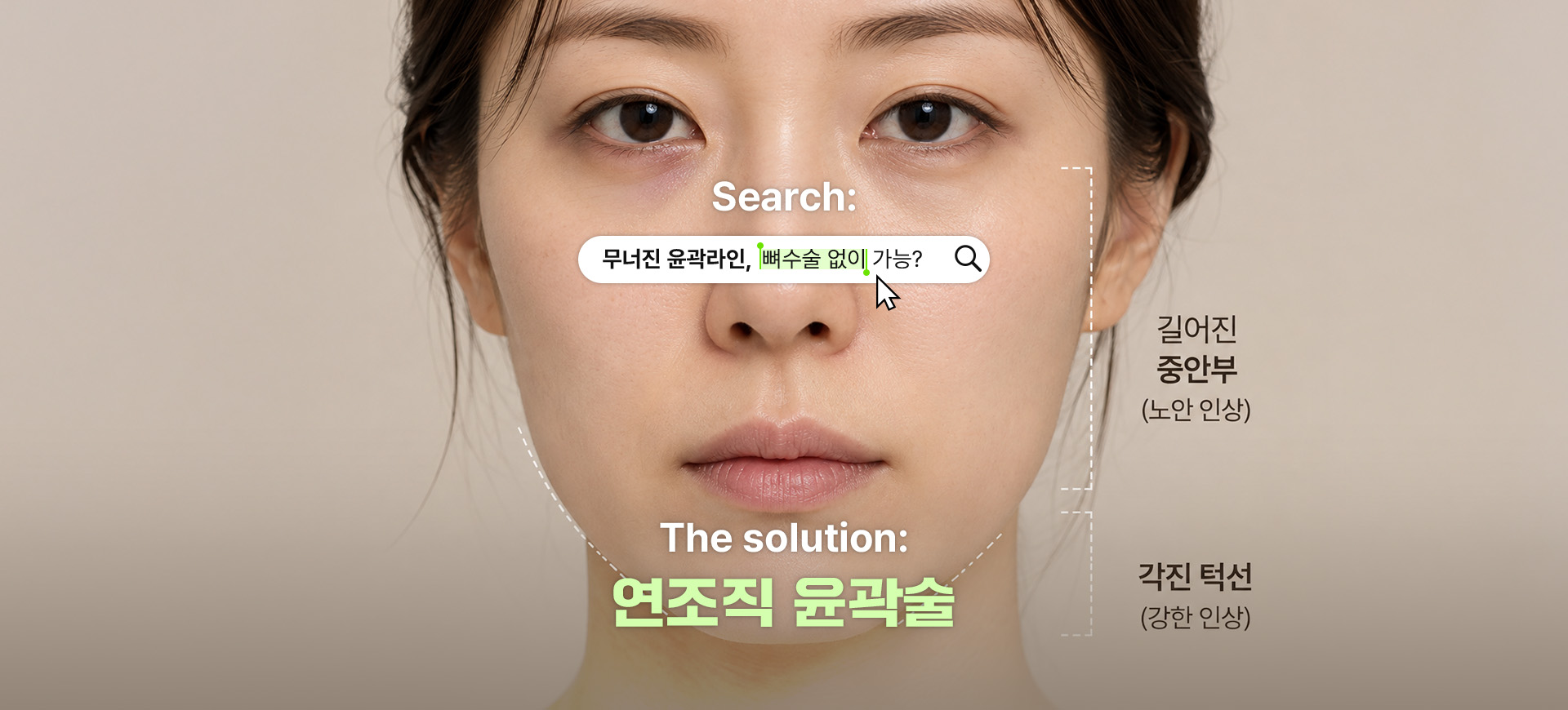 Search: 무너진 윤곽라인, 뼈수술 없이 가능? — The solution: 연조직 윤곽술