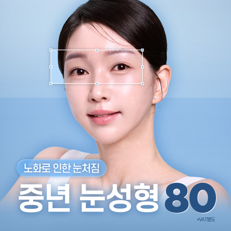 중년눈성형